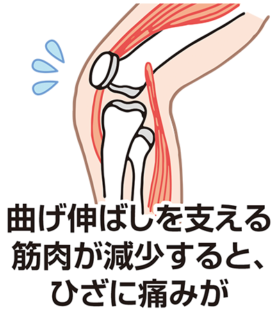 曲げ伸ばしを支える筋肉が減少すると、ひざに痛みが